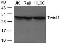 WB analysis of extracts from JK, Raji, and HL-60 cells using GTX50821 Twist1 antibody.