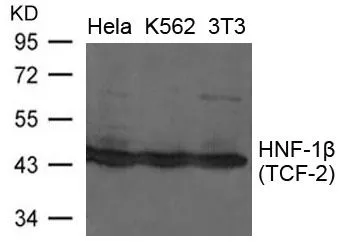 WB analysis of extracts from HeLa, K562, and 3T3 cells using GTX50838 HNF1 beta antibody?. WB analysis of extracts from HeLa, K562, and 3T3 cells using GTX50838 HNF1 beta antibody?.