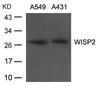 WB analysis of extracts from A549 and A431 cells using GTX50849 WISP2 antibody. WB analysis of extracts from A549 and A431 cells using GTX50849 WISP2 antibody.