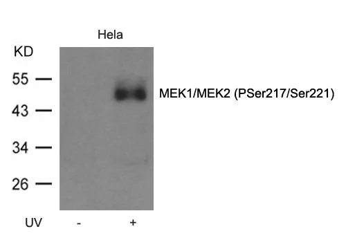 WB analysis of extracts from HeLa cell untreated or treated with UV using GTX50860 MEK1/MEK2 (phospho Ser217/Ser221) antibody.