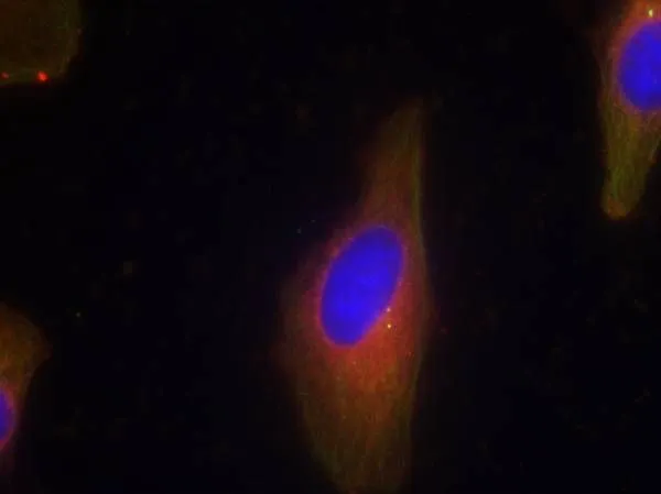 ICC/IF analysis of methanol-fixed HeLa cells using GTX50862 Synaptotagmin 1/2 antibody. ICC/IF analysis of methanol-fixed HeLa cells using GTX50862 Synaptotagmin 1/2 antibody.
