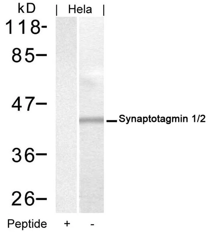 WB analysis of extracts from HeLa cells using GTX50862 Synaptotagmin 1/2 antibody with or without blocking peptide.