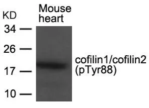 WB analysis of extracts from mouse heart tissue using GTX50866 Cofilin (phospho Tyr89) antibody.