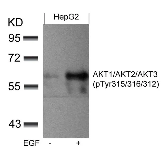 WB analysis of extracts from HepG2 cells untreated or treated with EGF using GTX50869 AKT (phospho Tyr315) antibody.
