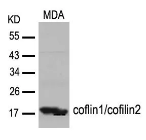 WB analysis of extracts from MDA cells using GTX50872 Coflin1/Cofilin2 antibody.