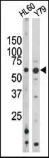WB analysis of HL-60 and Y79 cell lysate using GTX50885 Rad9 (phospho Ser328) antibody. WB analysis of HL-60 and Y79 cell lysate using GTX50885 Rad9 (phospho Ser328) antibody.
