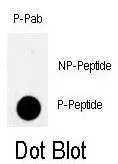 Dot Blot analysis of Rad9 phospho- or Non phospho-peptide using GTX50885 Rad9 (phospho Ser328) antibody. 50ng of Phospho-peptide or Non phospho-peptide per dot were adsorbed. Dilution : 0.5microg/ml