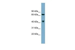 WB analysis of ACHN cells using GTX50891 GLS antibody at 0.2-1microg/ml.