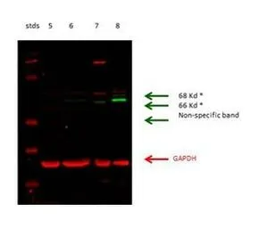 WB analysis of rat kidney cortex, kidney proximal tubules from cortex, rat brain tissue, and pig LLCPK1-F cells using GTX50891 GLS antibody at 1:2000. Lane 5 : rat kidney cortex Lane 6 : rat kidney proximal tubules from cortex Lane 7 : pig LLCPK1-F cells Lane 8 : rat brain