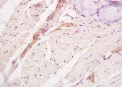 IHC-P analysis of rat tongue tissue using GTX50895 Tenascin C antibody. Dilution : 1:200 IHC-P analysis of rat tongue tissue using GTX50895 Tenascin C antibody. Dilution : 1:200
