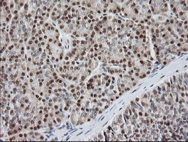 IHC-P analysis of human pancreas tissue using GTX50967 MCTS1 antibody [2G2]. Antigen retrieval : Heat-induced epitope retrieval by 10mM citrate buffer, pH6.0, 120oC for 3min.