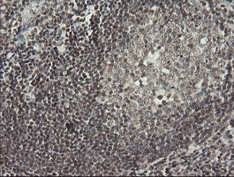 IHC-P analysis of human tonsil tissue using GTX50967 MCTS1 antibody [2G2]. Antigen retrieval : Heat-induced epitope retrieval by 10mM citrate buffer, pH6.0, 120oC for 3min.