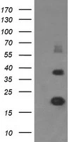 WB analysis of E. coli lysate (Left lane) or E. coli lysate containing recombinant protein fragment for human MCTS1 (NP_054779) gene (amino acids 1-181) (Right lane) using GTX50967 MCTS1 antibody [2G2]. Loading : 5 ug per lane