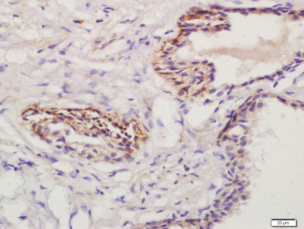 IHC-P analysis of human prostate tissue using GTX50972 Prostaglandin E Receptor EP1 antibody. Dilution : 1:200