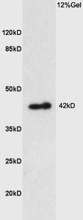 WB analysis of various samples using GTX50972 Prostaglandin E Receptor EP1 antibody. Dilution : 1:200 Lane 1 : mouse kidney lysates