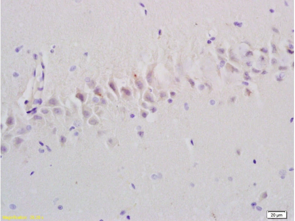 IHC-P analysis of rat brain tissue using GTX50979 Emp1 antibody. Dilution : 1:200