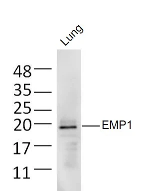 WB analysis of mouse lung tissue lysate using GTX50979 Emp1 antibody. Dilution : 1:300