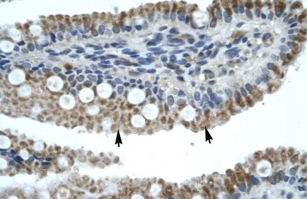 IHC-P analysis of human intestine tissue using GTX50980 ZNF683 antibody at 4.0-8.0microg/ml.