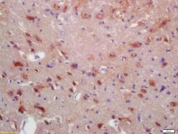 IHC-P analysis of rat brain tissue using GTX51055 MRF antibody. Dilution : 1:200 IHC-P analysis of rat brain tissue using GTX51055 MRF antibody. Dilution : 1:200
