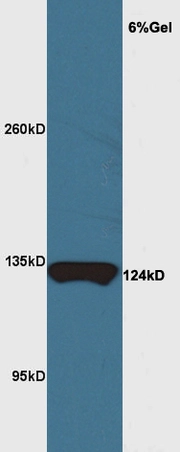 WB analysis of mouse brain tissue lysate using GTX51055 MRF antibody. Dilution : 1:200