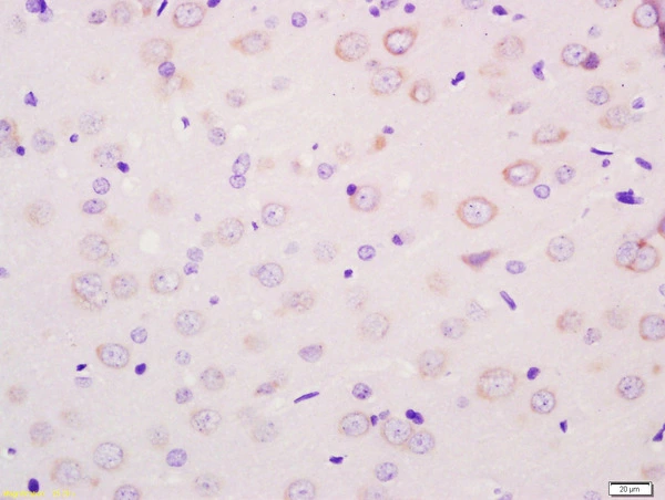 IHC-P analysis of rat brain tissue using GTX51095 MCT8 antibody. Dilution : 1:200