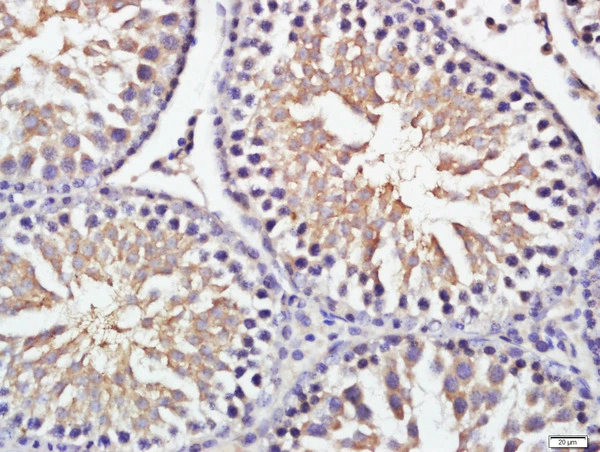 IHC-P analysis of rat testis tissue using GTX51232 GRINA antibody. Antigen retrieval : Boiling in sodium citrate buffer (pH6) for 15min Dilution : 1:200 IHC-P analysis of rat testis tissue using GTX51232 GRINA antibody. Antigen retrieval : Boiling in sodium citrate buffer (pH6) for 15min Dilution : 1:200