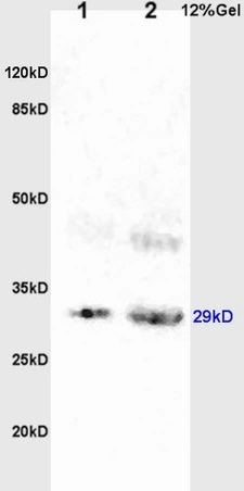 IHC-P analysis of human kidney tissue using GTX51308 BAMBI antibody. Antigen retrieval : Boiling in sodium citrate buffer (pH6) for 15min Dilution : 1:200