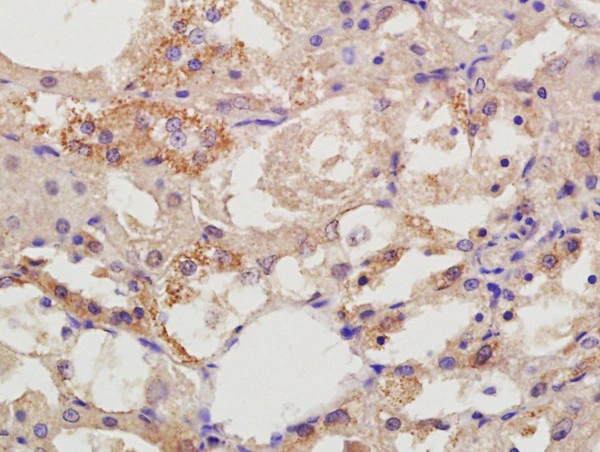 IHC-P analysis of rat kidney tissue using GTX51331 DIAPH2 antibody. Dilution : 1:200