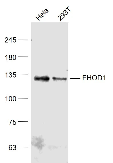 WB analysis of various samples using GTX51345 FHOD1 antibody. Dilution : 1:1000 Lane 1 : Mouse muscle lysates Lane 2 : Rat Cerebrum lysates