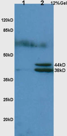 WB analysis of various samples using GTX51524 Haptoglobin antibody. Dilution : 1:200 Lane 1 : rat lung lysates Lane 2 : rat liver lysates