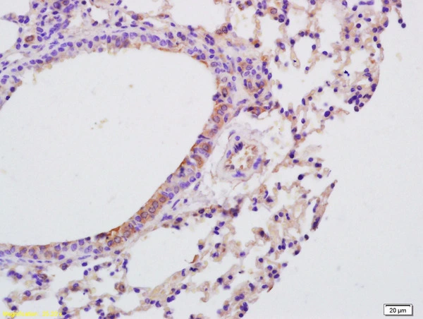 IHC-P analysis of mouse lung tissue using GTX51537 IL9 antibody. Dilution : 1:200 IHC-P analysis of mouse lung tissue using GTX51537 IL9 antibody. Dilution : 1:200