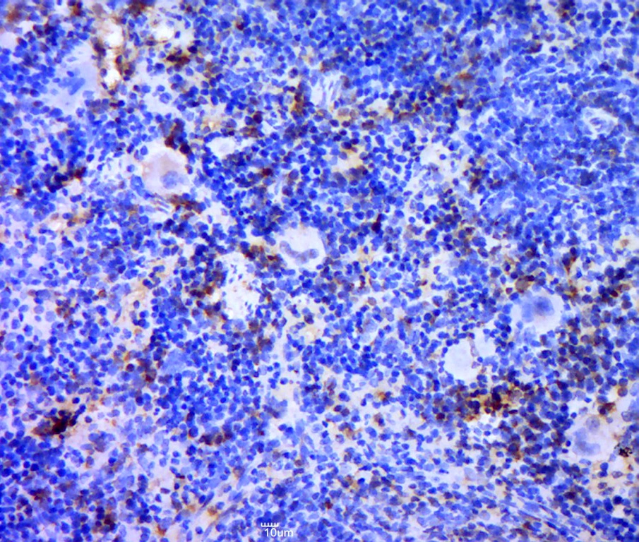 IHC-P analysis of rat spleen tissue using GTX51550 TREML1 antibody. Antigen retrieval : Boiling in sodium citrate buffer (pH6) for 15min Dilution : 1:400