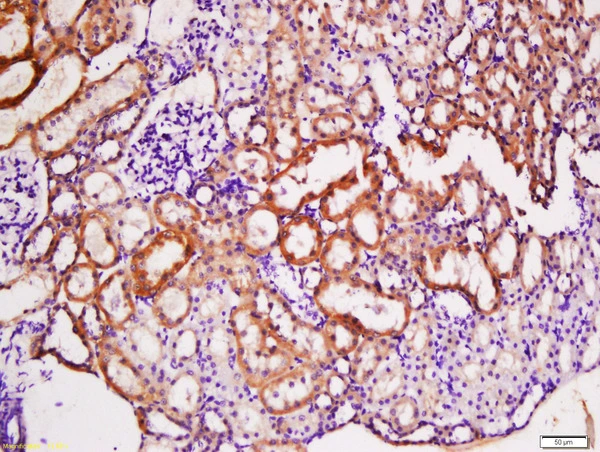 IHC-P analysis of rat kidney tissue using GTX51554 TACI antibody. Dilution : 1:200 IHC-P analysis of rat kidney tissue using GTX51554 TACI antibody. Dilution : 1:200