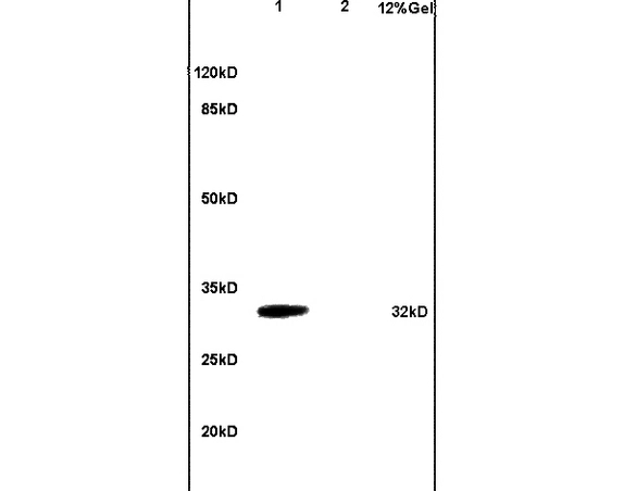 WB analysis of various samples using GTX51554 TACI antibody. Dilution : 1:200 Lane 1 : mouse brain lysates Lane 2 : mouse heart lysates