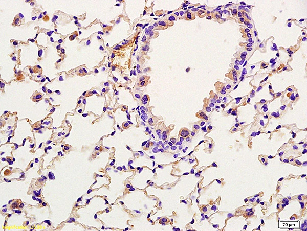 WB analysis of various samples using GTX51565 TORC2 (phospho Ser171) antibody. Dilution : 1:200 Lane 1 : human rectal carcinoma lysates Lane 2 : human gastric carcinoma lysates