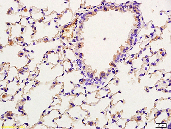 IHC-P analysis of rat lung tissue using GTX51565 TORC2 (phospho Ser171) antibody. Dilution : 1:200 IHC-P analysis of rat lung tissue using GTX51565 TORC2 (phospho Ser171) antibody. Dilution : 1:200