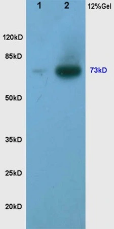 WB analysis of various samples using GTX51565 TORC2 (phospho Ser171) antibody. Dilution : 1:200 Lane 1 : human rectal carcinoma lysates Lane 2 : human gastric carcinoma lysates