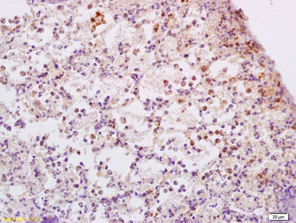 IHC-P analysis of rat lung tissue using GTX51578 ADCY9 antibody. Dilution : 1:200 IHC-P analysis of rat lung tissue using GTX51578 ADCY9 antibody. Dilution : 1:200