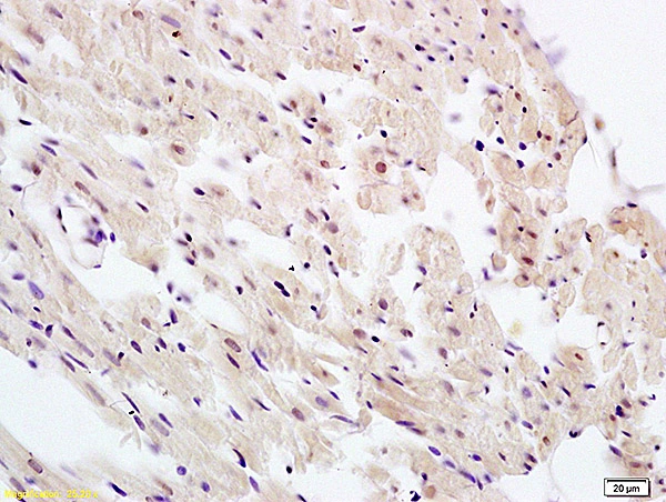 IHC-P analysis of rat heart tissue using GTX51584 UBL7 antibody. Dilution : 1:100 IHC-P analysis of rat heart tissue using GTX51584 UBL7 antibody. Dilution : 1:100