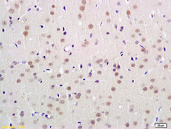 IHC-P analysis of rat brain tissue using GTX51584 UBL7 antibody. Dilution : 1:100
