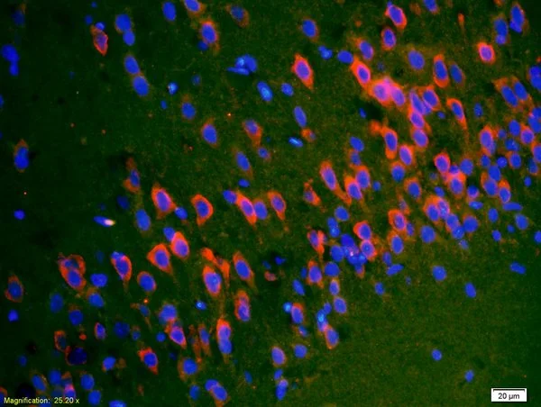 IHC-P analysis of rat brain tissue using GTX51590 SYTL5 antibody. Dilution : 1:200 IHC-P analysis of rat brain tissue using GTX51590 SYTL5 antibody. Dilution : 1:200