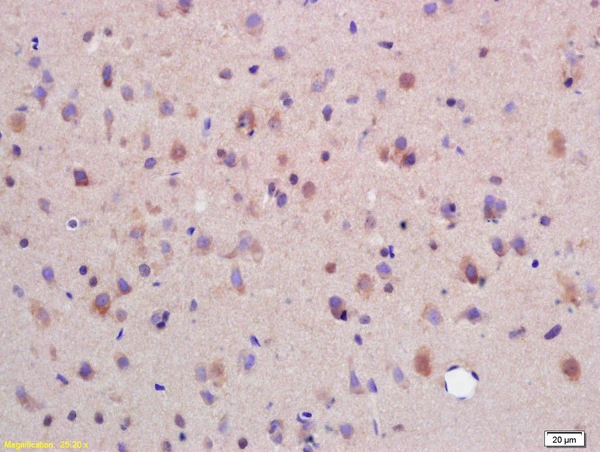 IHC-P analysis of rat brain tissue using GTX51590 SYTL5 antibody. Dilution : 1:200