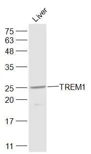 WB analysis of rat liver tissue lysate using GTX51612 TREM1 antibody. Dilution : 1:1000