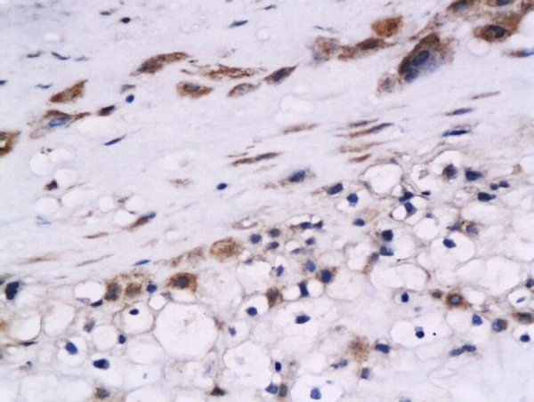 IHC-P analysis of human placenta tissue using GTX51631 Cystatin B antibody. Dilution : 1:200 IHC-P analysis of human placenta tissue using GTX51631 Cystatin B antibody. Dilution : 1:200
