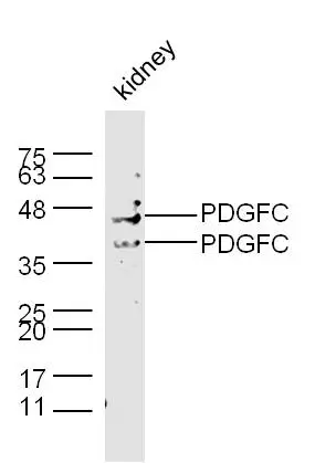 WB analysis of mouse kidney tissue lysate using GTX51652 PDGFC antibody. Dilution : 1:300