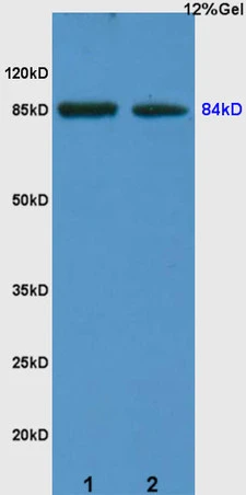 WB analysis of various samples using GTX51654 ARHGAP24 antibody. Dilution : 1:200 Lane 1 : human colon carcinoma lysates Lane 2 : rat kidney lysates