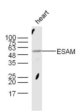 WB analysis of mouse heart tissue lysate using GTX51657 ESAM antibody. Dilution : 1:300