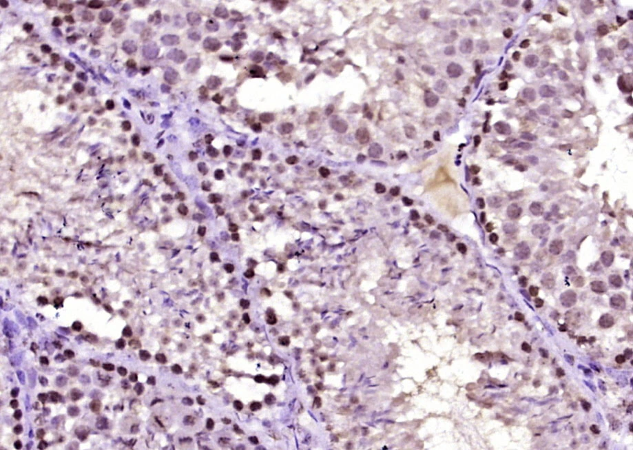 IHC-P analysis of mouse testis tissue using GTX51675 DNAJB4 antibody. Antigen retrieval : Boiling in sodium citrate buffer (pH6) for 15min Dilution : 1:400 IHC-P analysis of mouse testis tissue using GTX51675 DNAJB4 antibody. Antigen retrieval : Boiling in sodium citrate buffer (pH6) for 15min Dilution : 1:400