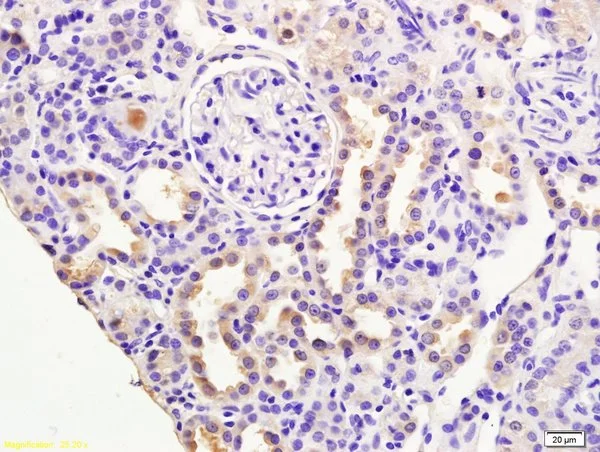 IHC-P analysis of mouse kidney tissue using GTX51688 RASSF3 antibody. Dilution : 1:200 IHC-P analysis of mouse kidney tissue using GTX51688 RASSF3 antibody. Dilution : 1:200