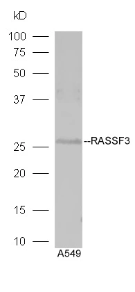 WB analysis of A549 cell lysates using GTX51688 RASSF3 antibody. Dilution : 1:300